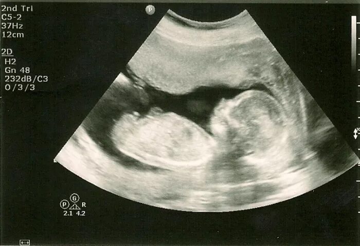 Here is our take on monthly baby photos with flowers! Monthly baby pictures, Mon