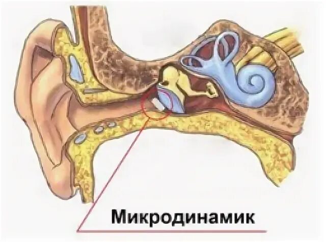 Микронаушник на барабанную перепонку. Строение уха микронаушник. Магнитный микронаушник в ухе. Что делать если в ухе застряла вода