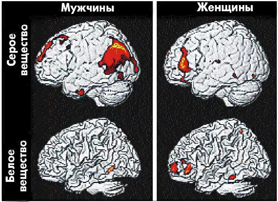 Мозг мужчины и женщины различия. Мужской и женский мозг. Мозг мужчины и женщины. Мужской и женский мозг различия.