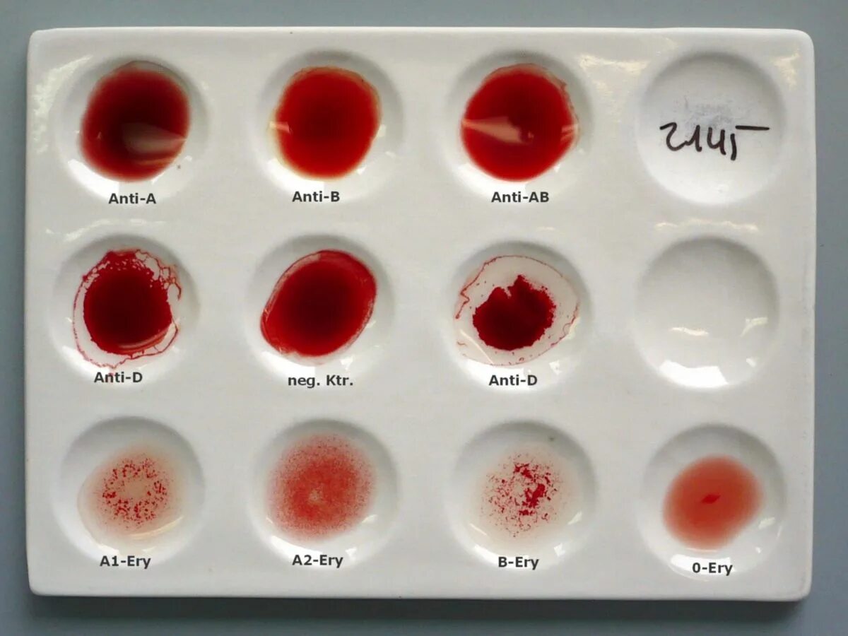 Тарелка для определения группы крови. Чашка для определения группы крови. Определение группы крови фото. Цвета групп крови. Кровь без резуса