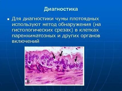 Чума метод диагностики