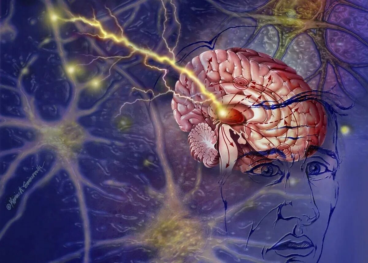 Нервная система человека память. Неврология мозг. Эпилепсия головной мозг. Мозг эпилептика.