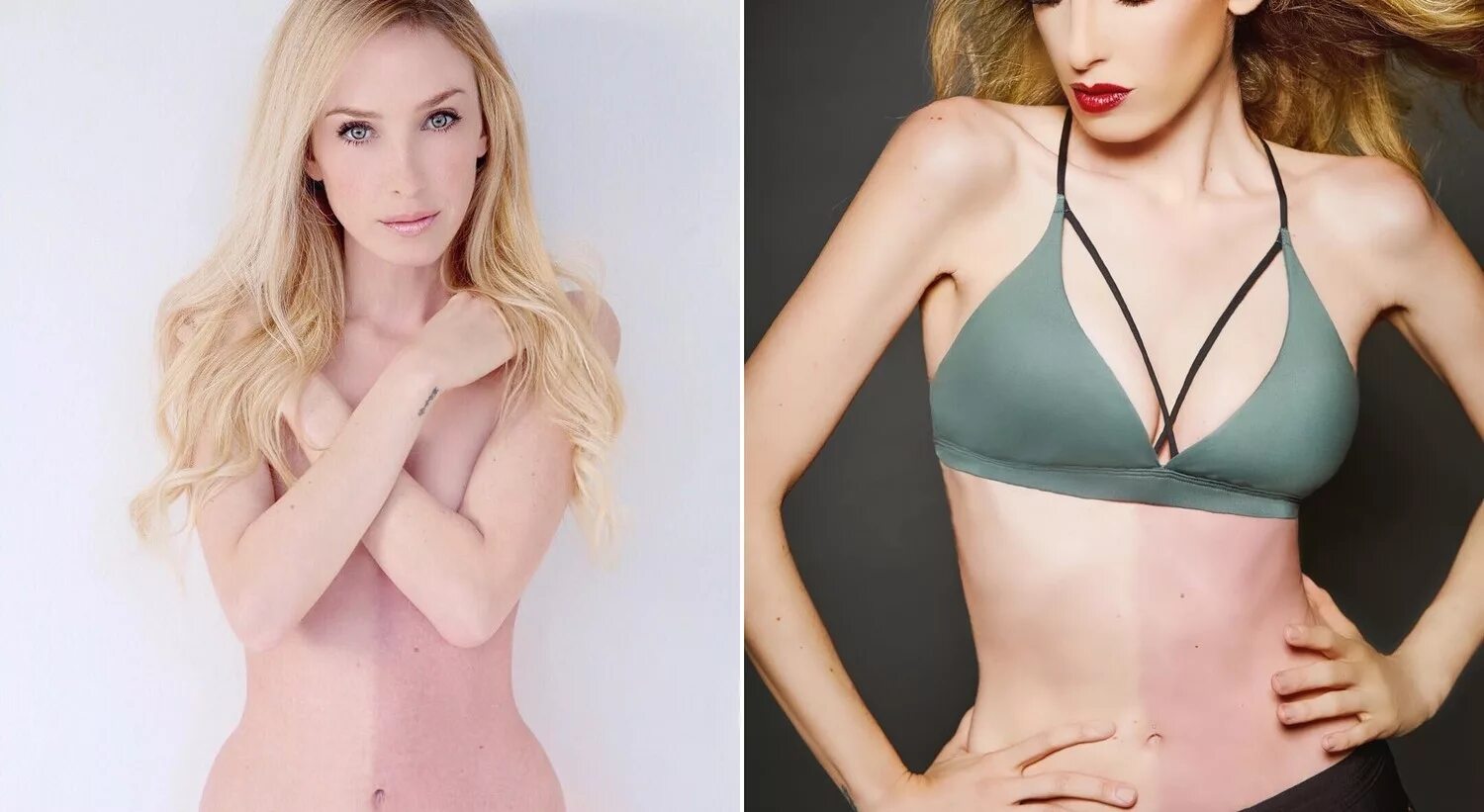 химера с двумя днк