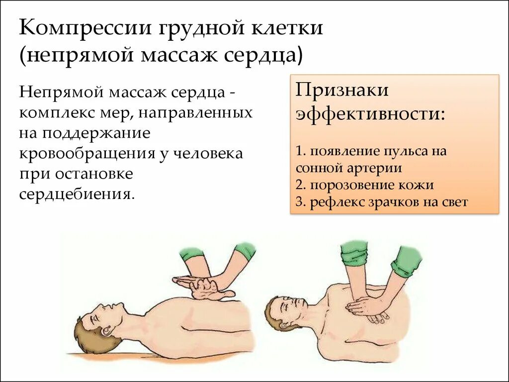 СЛР компрессии грудной клетки. Глубина компрессии грудной клетки при проведении СЛР. Глубина компрессий грудной клетки при проведении непрямого массажа. Частота компрессий грудной клетки при закрытом массаже сердца. Осложнения при закрытом массаже сердца