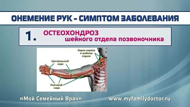 Ночью немеет правая кисть. Немеют руки. болит и немеет левая рука от плеча причины. онемение конечностей руки.