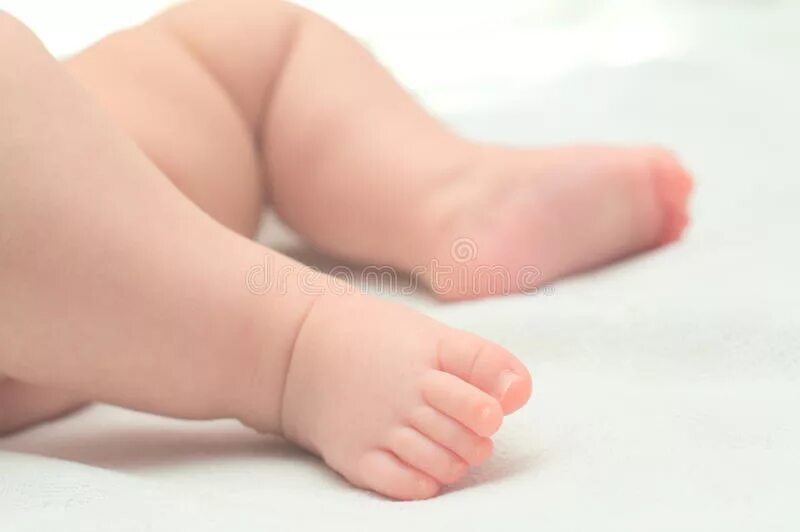 Отек ног у новорожденных. Пяточные стопы новорожденных.