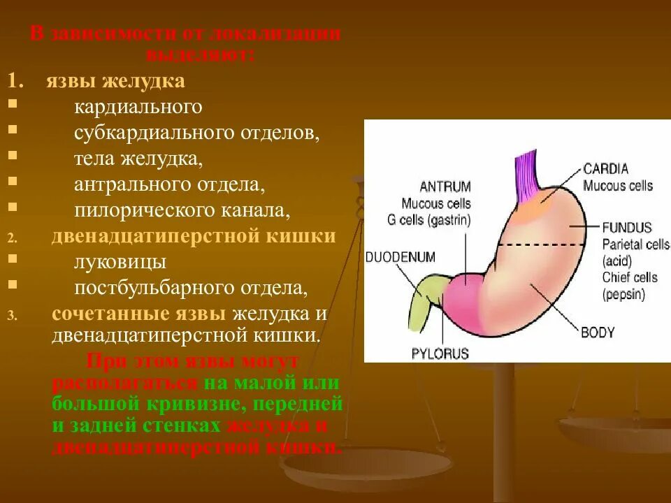 Язвенная болезнь желудка локализация язвы. Язвенная болезнь локализация язв. Луковица 12 перстной кишки постбульбарный отдел. Язва кардиального и субкардиального отдела желудка. Локализация язвы желудка