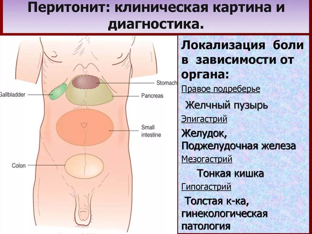 Диагностика перитонита. Клиническая картина перитонита. Локализация боли при перитоните. Клиническая картина перитони. Перитонит диагностика симптомы.