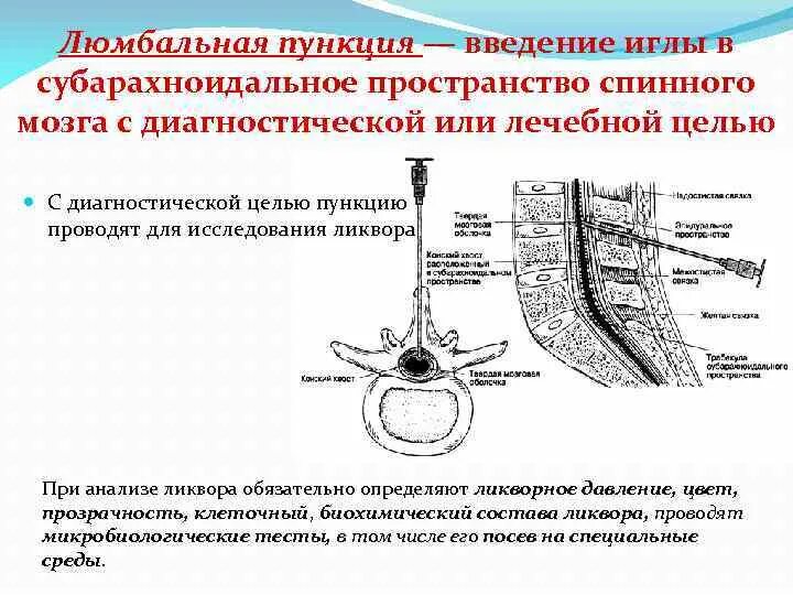 Жидкость в спинном канале. Оболочки спинного мозга ликвор. Спинномозговая пункция топографическая анатомия. Спинномозговая пункция этапы. Игла при люмбальной пункции.