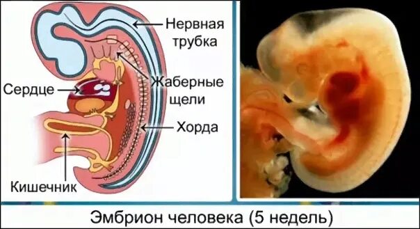 Наличие хорды у человека. Эмбрион человека строение хорда. Наличие хорды у зародыша. Хорда у зародыша.