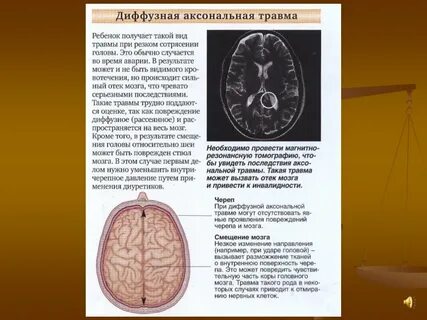 Диффузные нарушения мозга