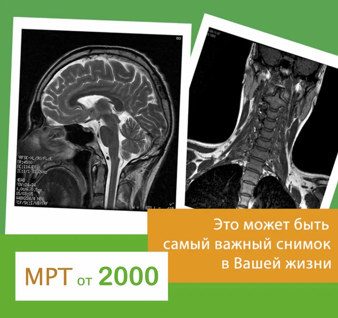 Можно заменить кт на мрт. Возможно самый важный снимок. мрт 2000. показания кт и мрт органов брюшной полости.