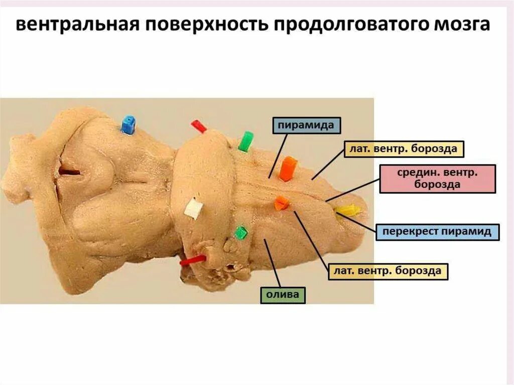 Вентральная поверхность продолговатого мозга. Перекрест пирамид продолговатого мозга. Строение вентральной поверхности продолговатого мозга. Продолговатый мозг анатомия препарат. Перекрест пирамид анатомия.