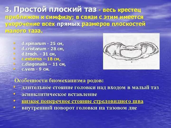 Современный таз. Простой плоский таз. плоский таз в акушерстве.
