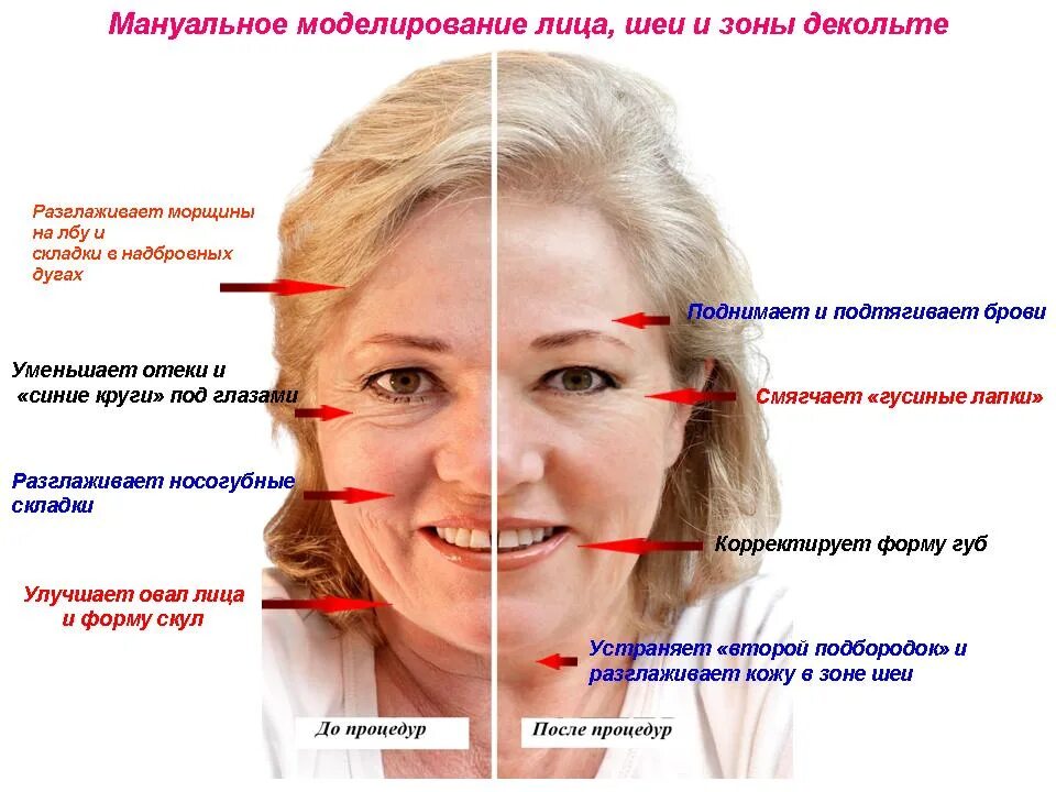 Лифтинг это простыми словами. Моделирование лица. Мануальное моделирование лица. Эстетическое мануальное моделирование лица. Структурное моделирование лица.