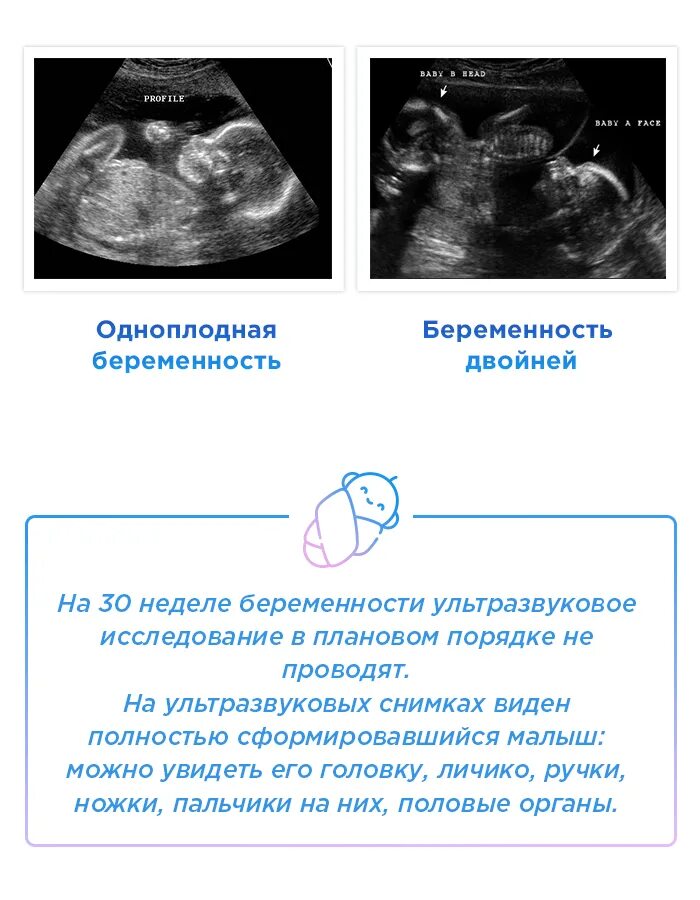 УЗИ 30 недель беременности. 30 Недель беременности УЗИ плода. УЗИ ребенка 30 недель беременности. Как выглядит ребенок на УЗИ В 32 недели.