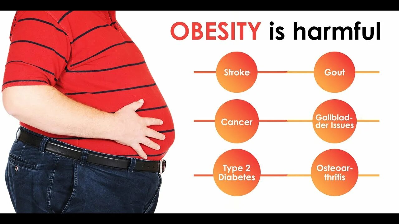 Избыточный вес. Чайлдхуд. Obesity diseases. Lead to obesity. Obesity diseases.