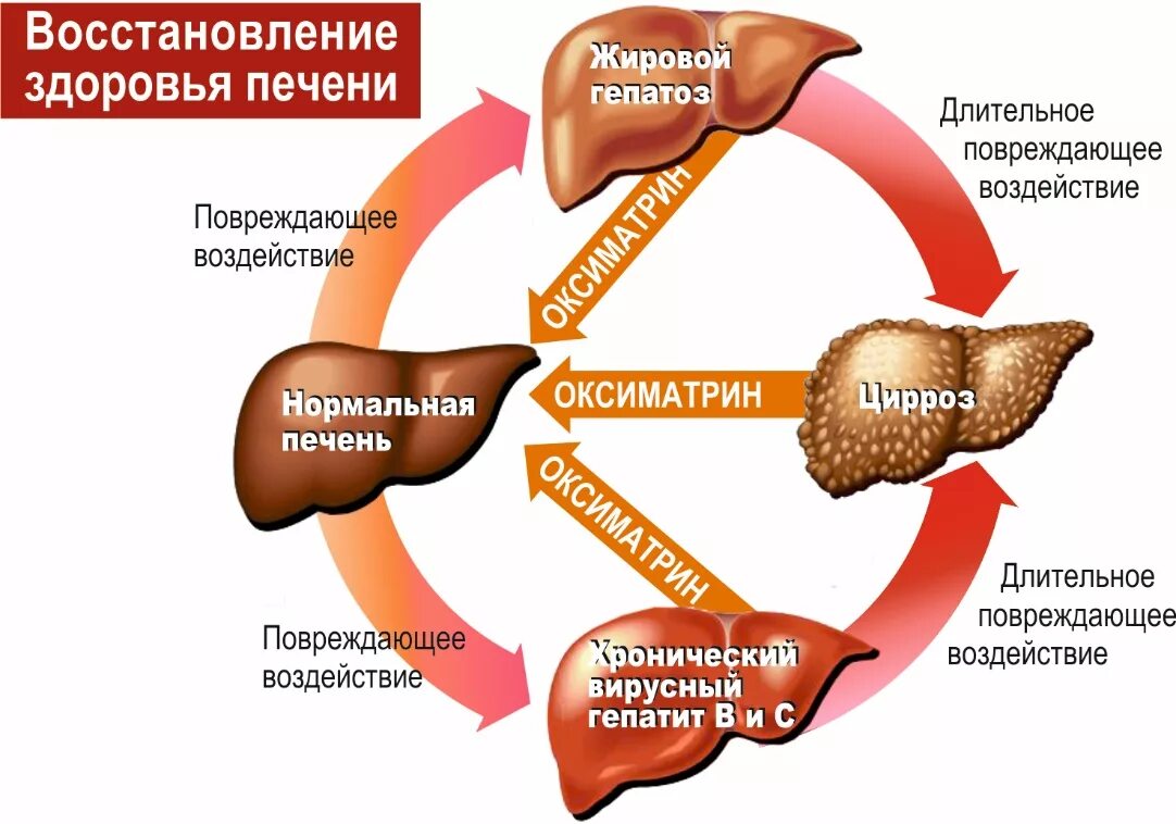 Степени фиброза печени. Фазы заболевания печени.