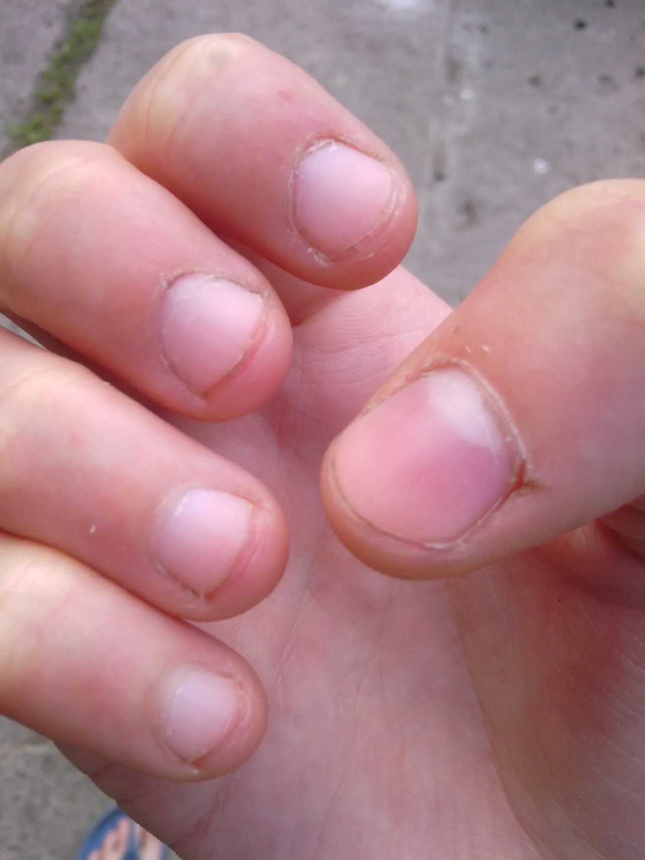 Here’s What The Little Half Moon Under Our Fingernails Means - YouTube