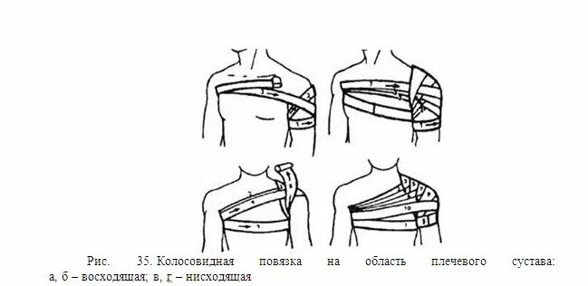 Плечевая повязка алгоритм. Колосовидная повязка на плечевой сустав алгоритм. Колосовидная повязка на плечо восходящая. Колосовидная повязка алгоритм. Восходящая колосовидная повязка на плечевой сустав.