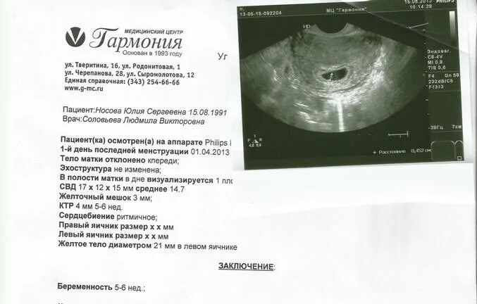 Диаметр желточного мешка 3.5 мм. СВД 18,6 мм желтый мешок 7 мм КТР 2.3 мм УЗИ. Акушерский срок 7-8 недель беременности размер плодного яйца. Желточный мешок на УЗИ 6 недель. 9 5 недель какого года