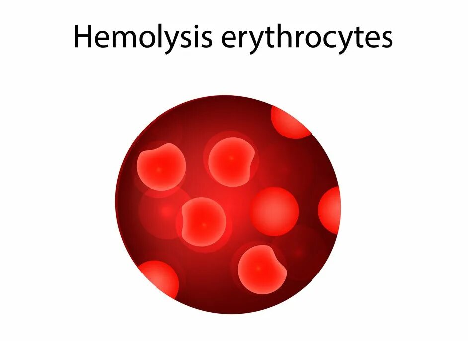 Ускоренный распад эритроцитов. Erythrocytes.