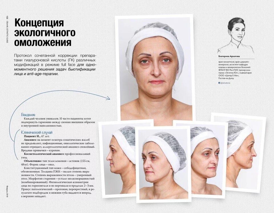 Методики омоложения лица