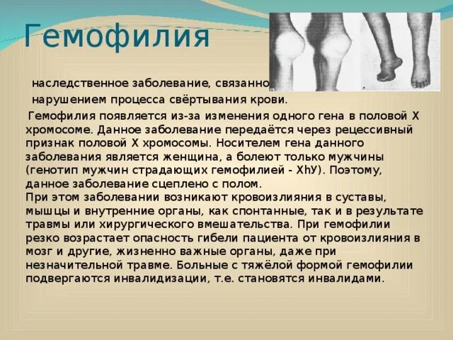 Гемофилия Тип наследования. Гемофилия заболевание. Гемофилия это наследственное заболевание. Болезнь гемофилия Тип наследования.