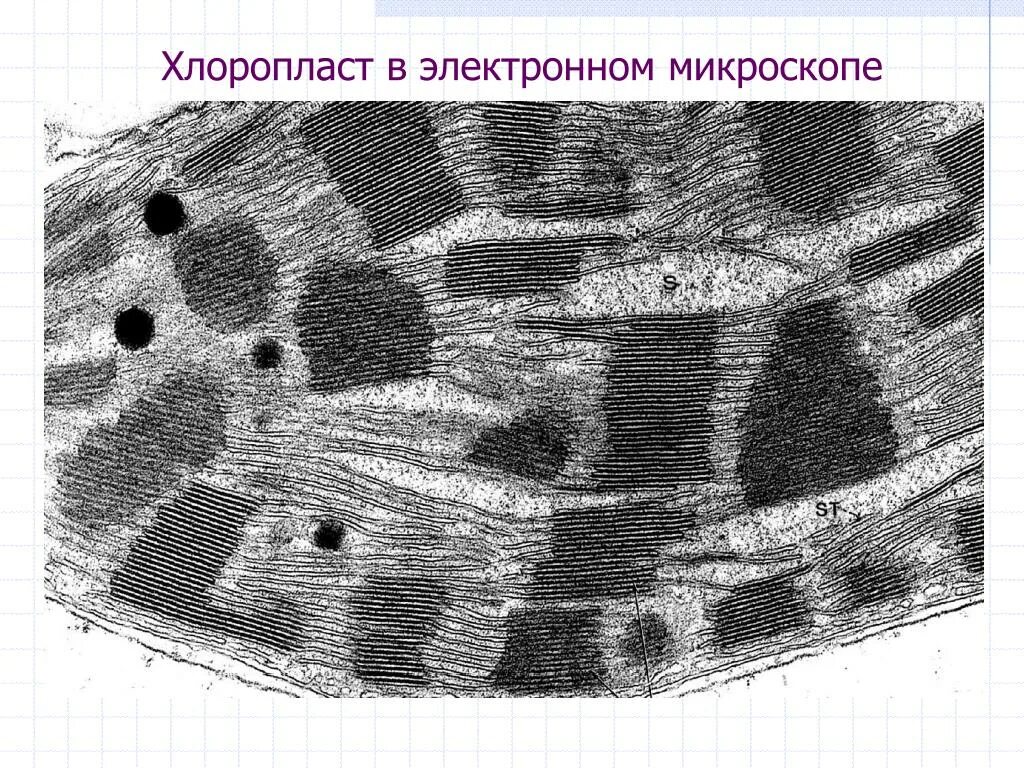 Хлоропласты микроскоп. Электронограмма пластиды. Микрофотографии органоидов клетки. Пластиды электронная микрофотография. Электронная микрофотография митохондрии.