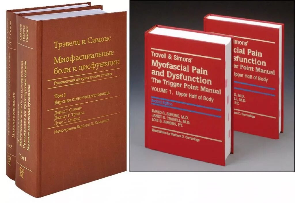 миофасциальный синдром триггерные точки спины. тревел триггерные точки. триггерные точки трапециевидной мышцы. тревел триггерные точки. триггерные точки мышц шеи.
