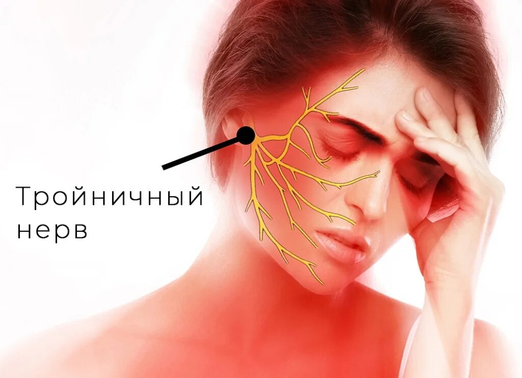 Троичный лицевой нерв воспаление. Невралгия тройничного нерва. Неврит и невралгия тройничного нерва. Воспаление троичного нерва.