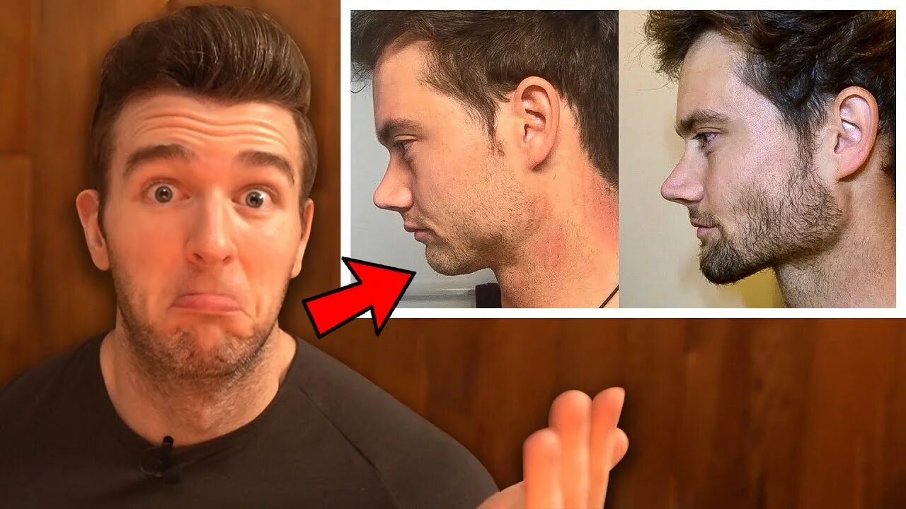 Что такое мьюинг для лица. Мьюинг для мужчин. Mewing инструкция. Mewing упражнения. Mewing before and after.