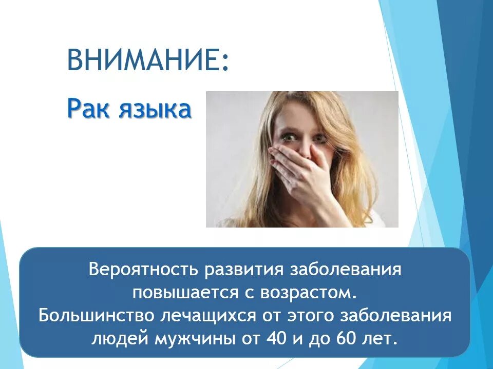 Как выглядит рак языка на начальной Нома (noma). Буква "Н"