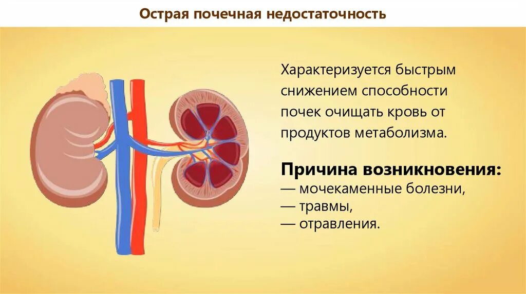 Болезни почек биология 8 класс. Заболевания органов мочевыделения. Заболевания выделительной системы. Болезни почек презентация. Заболевания мочевыделительной системы у детей.