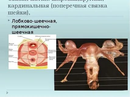 Где находится круглая связка