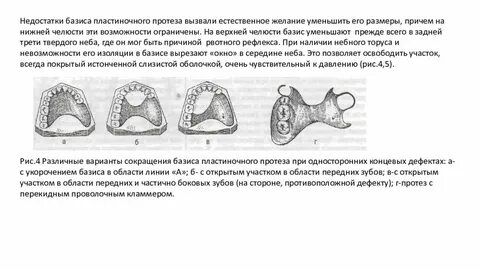 Характеристики протеза