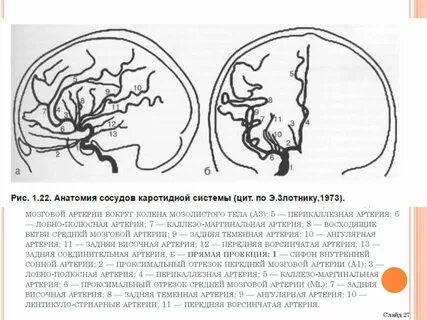 Церебральные артерии