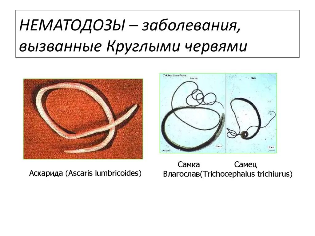 Нематодозы (круглые черви).. Заболевания вызванные круглыми червями. Нематодозы заболевания вызываемые. Круглые черви заболевания