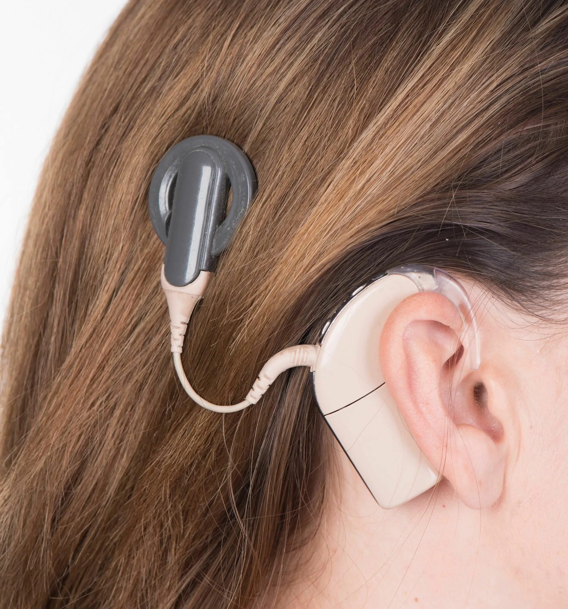 Аппарат Cochlear кохлеарный. Кохлеарный имплант кохлеар. Слуховой аппарат кохлеарный имплант. Слуховой аппарат Кохлер имплант. Операция на ухо на слух