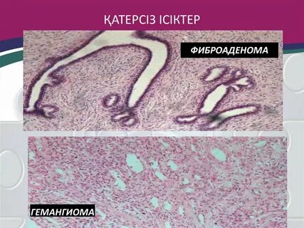 Лесбиянка көршісі көршісін азғырған.