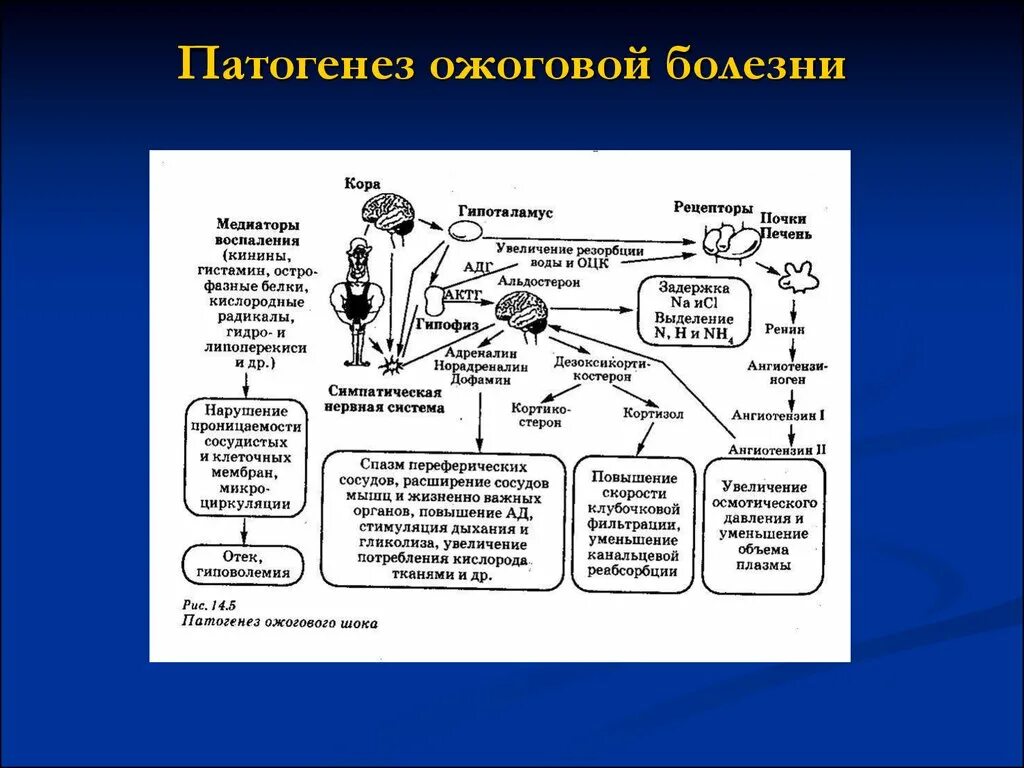 Степени шока при ожогах. Схема патогенеза ожоговой болезни. Механизм развития ожоговой болезни. Патогенез ожоговой болезни патофизиология. Ожоговая болезнь степени развития.