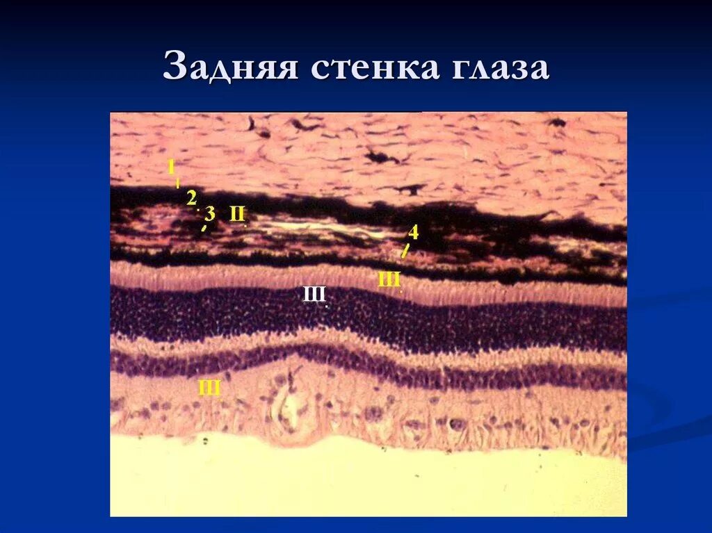 Препарат глаза гистология. Сетчатка гистология препарат. задняя стенка глаза сетчатка гистология препарат. сетчатка глаза гистология препарат. задняя стенка глаза гематоксилин эозин.