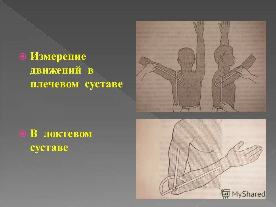 Возможные движения в локтевом суставе. Возможные движения в локтевом суставе. Лучелоктевой сустав сустав. Сгибание в локтевом суставе. Движения в локтевом суставе.