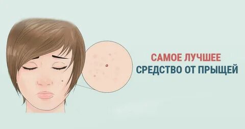 Народные методы от прыщей
