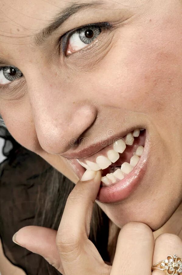 Biting girl