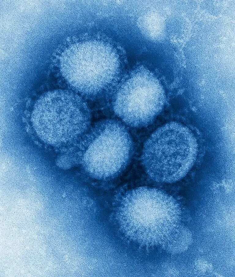 Грипп б 1. Вирус h1n1. Вирус гриппа h1n1. Вирус h1n1 под микроскопом. Пандемический грипп a/h1n1.