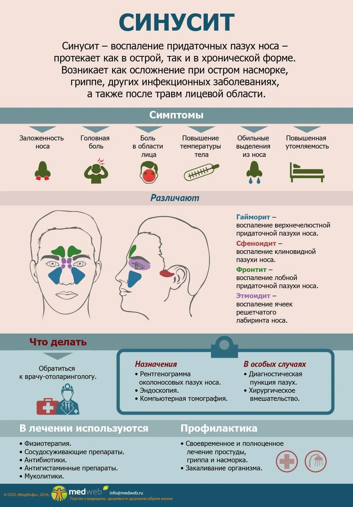 Фронтит симптомы у взрослых с температурой. Фронтит симптомы у взрослых с температурой