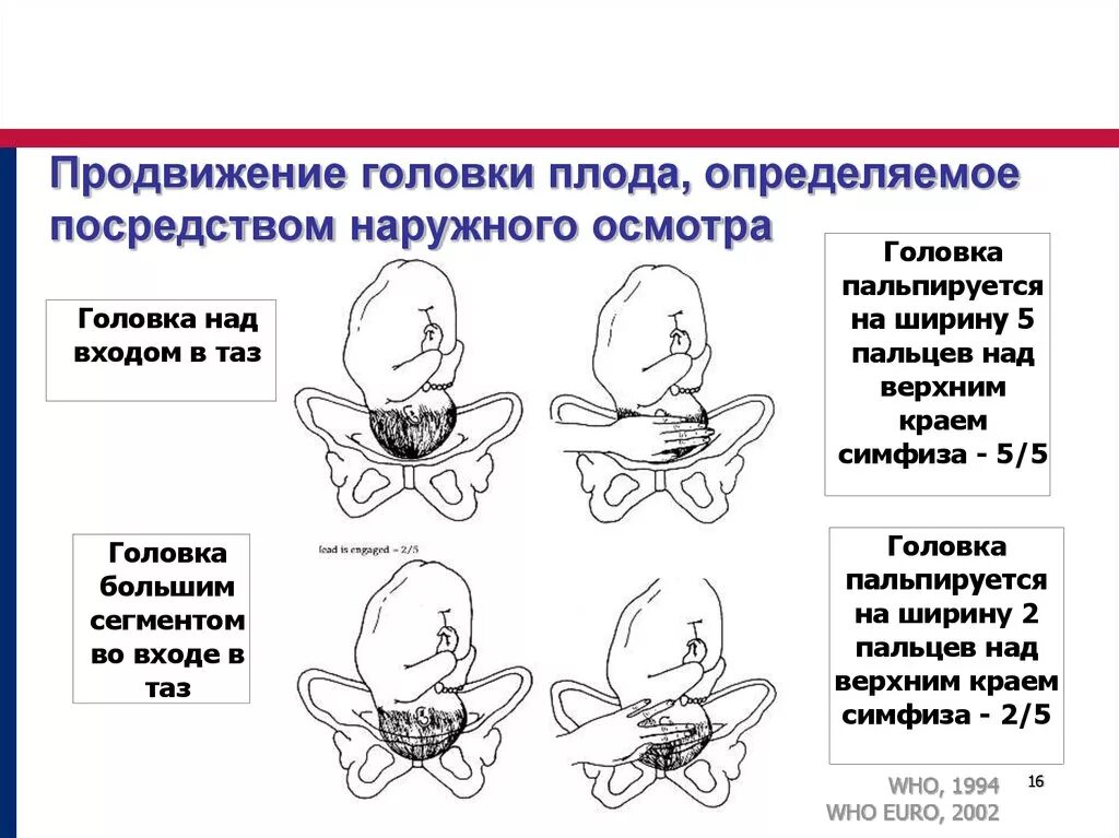 Положения головки плода. Головка плода на тазовом дне. Опускание головки плода. Расположение головки плода.