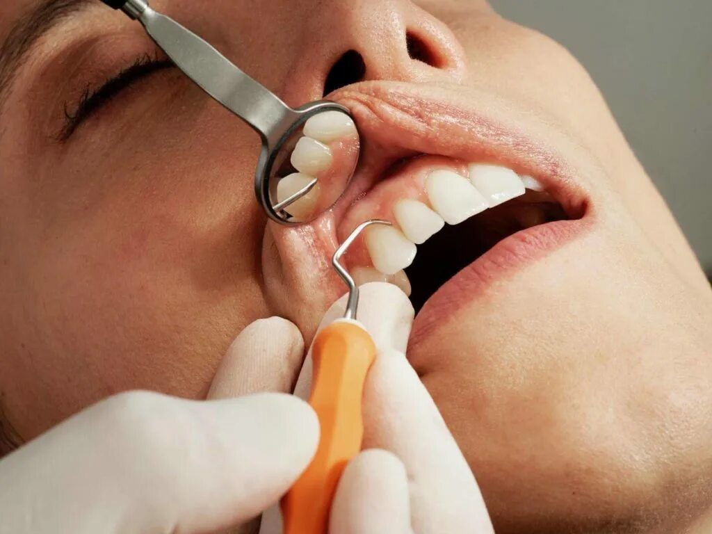 Зубы стоматология. Заболевания зубов и десен. Зубы с кариесом стоматология. Неприятное ощущение на зубах