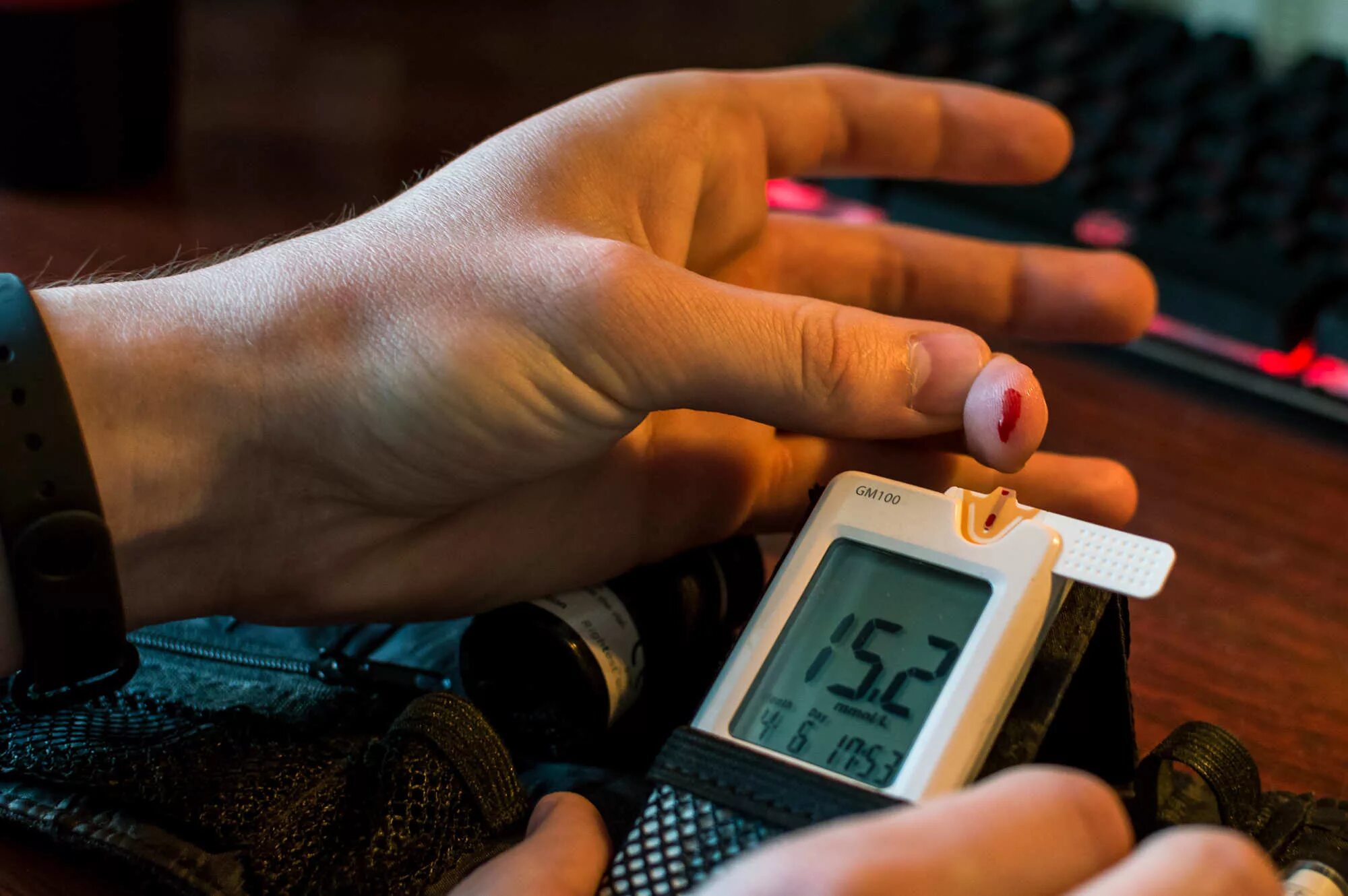 Экспресс-анализатор концентрации глюкозы в крови. Рука с глюкометром. Пальцы после глюкометра. Сахарный диабет измерение. Неинвазивный глюкометр glucovista cgm-350.
